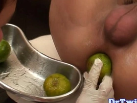 Asian twink prostate checked with big dildo chinese gay bam dildo #1 : porn tube