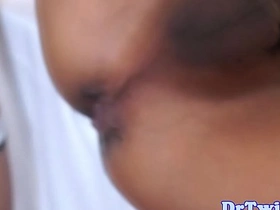 Asian MD slams patient after enema chinese rosebud gay porn